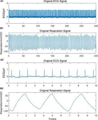 Cardiorespiratory Coupling Analysis Based on Entropy and Cross-Entropy in Distinguishing Different Depression Stages